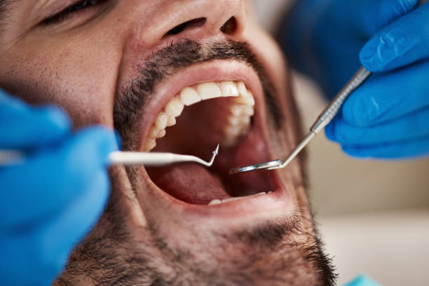 Best Cosmetic Emergency Dentistry in Teutopolis, IL