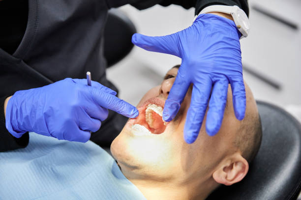 Best Emergency Dental Care for Broken or Chipped Teeth in Teutopolis, IL